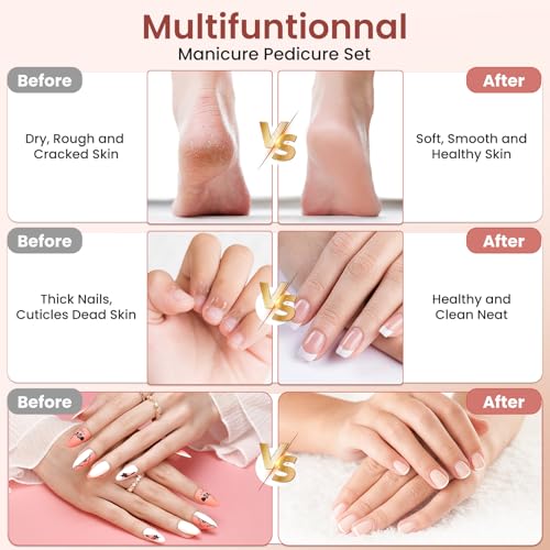 Maniküre/Pediküre Set von : Kabelloser Nagelfräser mit 6 Aufsätzen und LED Licht für perfekte Hände- und Fußpflege